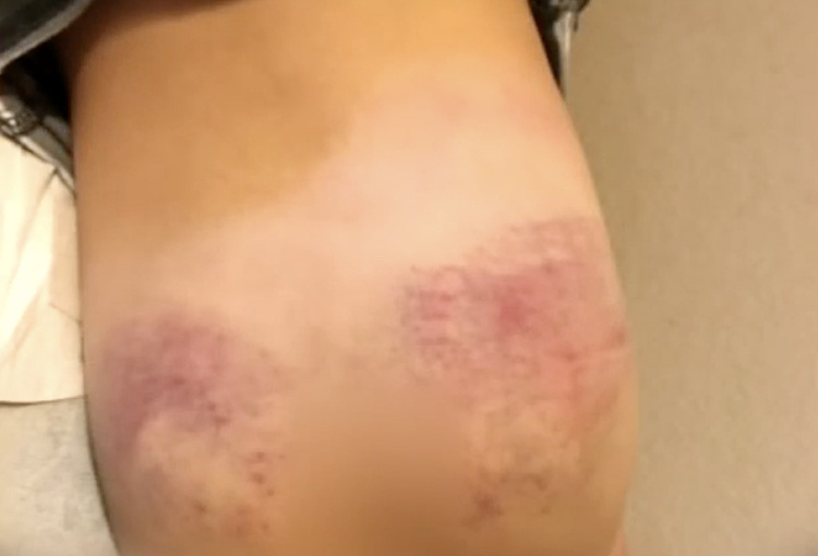 Two-Year-Old Fought Mom About Going to Daycare. That's When She Realized He Was Being Abused