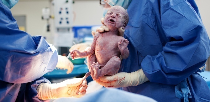 Baby Being Born in Hospital