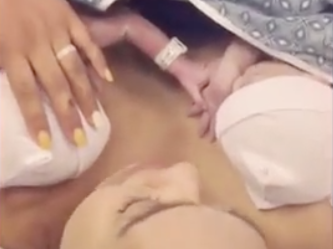 Video of Twins Holding Hands Right After Birth