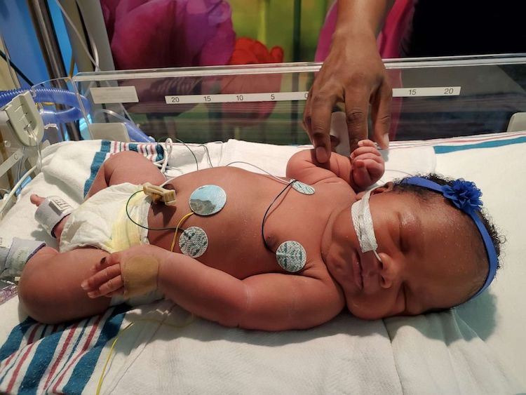 Meet This Baby Who Was Born on 9/11 at 9:11 Weighing 9 Pounds, 11 Ounces | A new mom marked 9/11 by bringing new life into the world. And, in a triple coincidence, the baby girl was born at 9:11 p.m. on 9/11 and weighed 9 lbs. and 11 oz.
