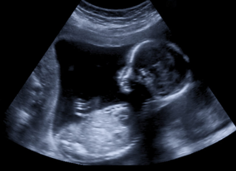 ultrasound baby
