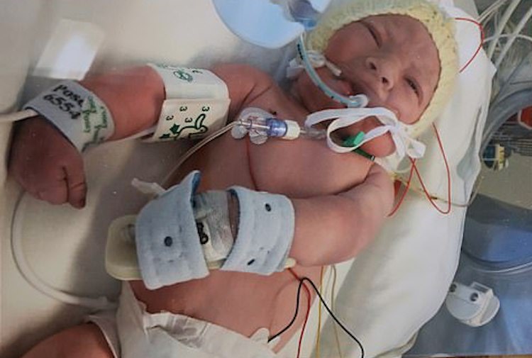 Baby Oscar: Unresponsive Baby Opens Eyes Just As Parents Say Their Final Goodbyes and Doctors Turn Off Life Support