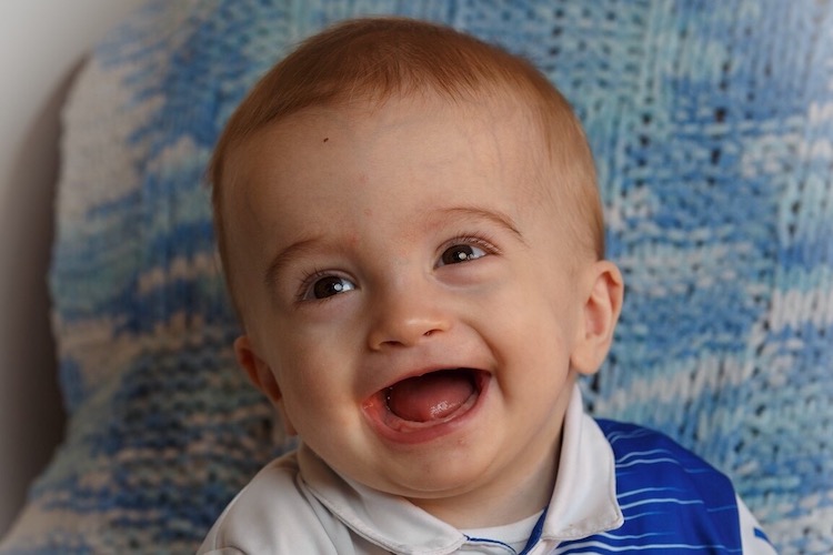 michael labuschagne: baby with rare tumor who awoke from a coma with a smile needs life-saving surgery in boston