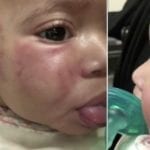 Unlicensed New Jersey Daycare Gets Shut Down After Baby Is Found With Bite Marks on Stomach and Bruises on Her Face