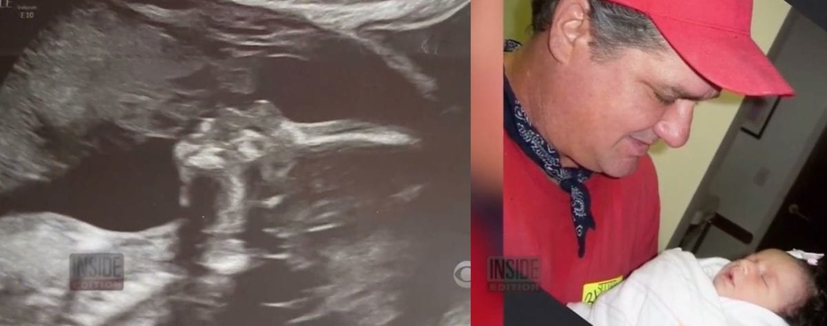 mom stunned after friend starting seeing her late dad kissing his granddaughter in latest sonogram picture | when shantel carrillo shared a sonogram of her child on social media, she was stunned by the responses. no, it wasn't because her baby was making a funny hand gesture or because the baby was making a funny face, but because many of the people who saw the photo believed an angel kissing her child.