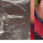 Mom Stunned After Friend Starting Seeing Her Late Dad Kissing His Granddaughter in Latest Sonogram Picture