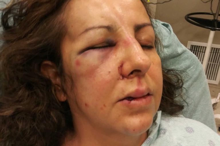 a california mom was reportedly beaten up by the same teens who were bullying her daughter when she went to talk to the school principal