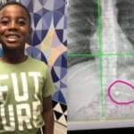 A 7-Year-Old Boy From Georgia Swallowed an Apple AirPod and Had to Be Taken to the Hospital