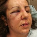A California Mom Was Reportedly Beaten Up by the Same Teens Who Were Bullying Her Daughter When She Went to Talk to the School Principal