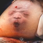 Best Birth Photography of 2019 Has Been Announced and All of the Images Can Only Be Described as Stunning; Take a Look at a Few of the Winners