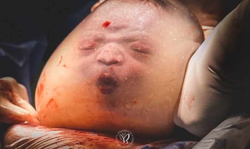 Best Birth Photography of 2019 Has Been Announced and All of the Images Can Only Be Described as Stunning; Take a Look at a Few of the Winners