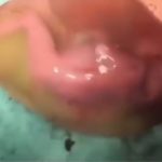 Rare Viral Video Shows Baby Kicking Inside  Mother's Amniotic Sac After Being Born