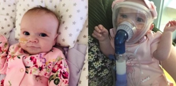 Baby Survives Heart Surgery, Catches Coronavirus While Recovering & Beats Virus Too