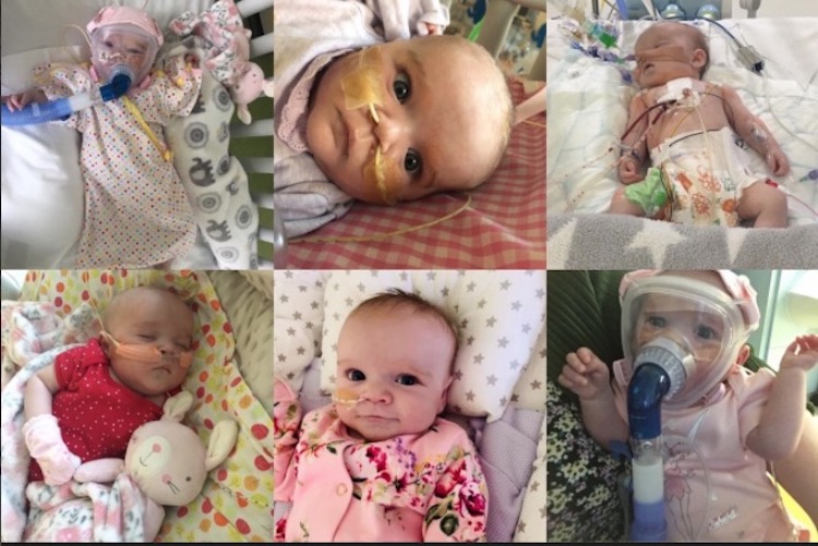 baby survives heart surgery, catches coronavirus while recovering & beats virus too