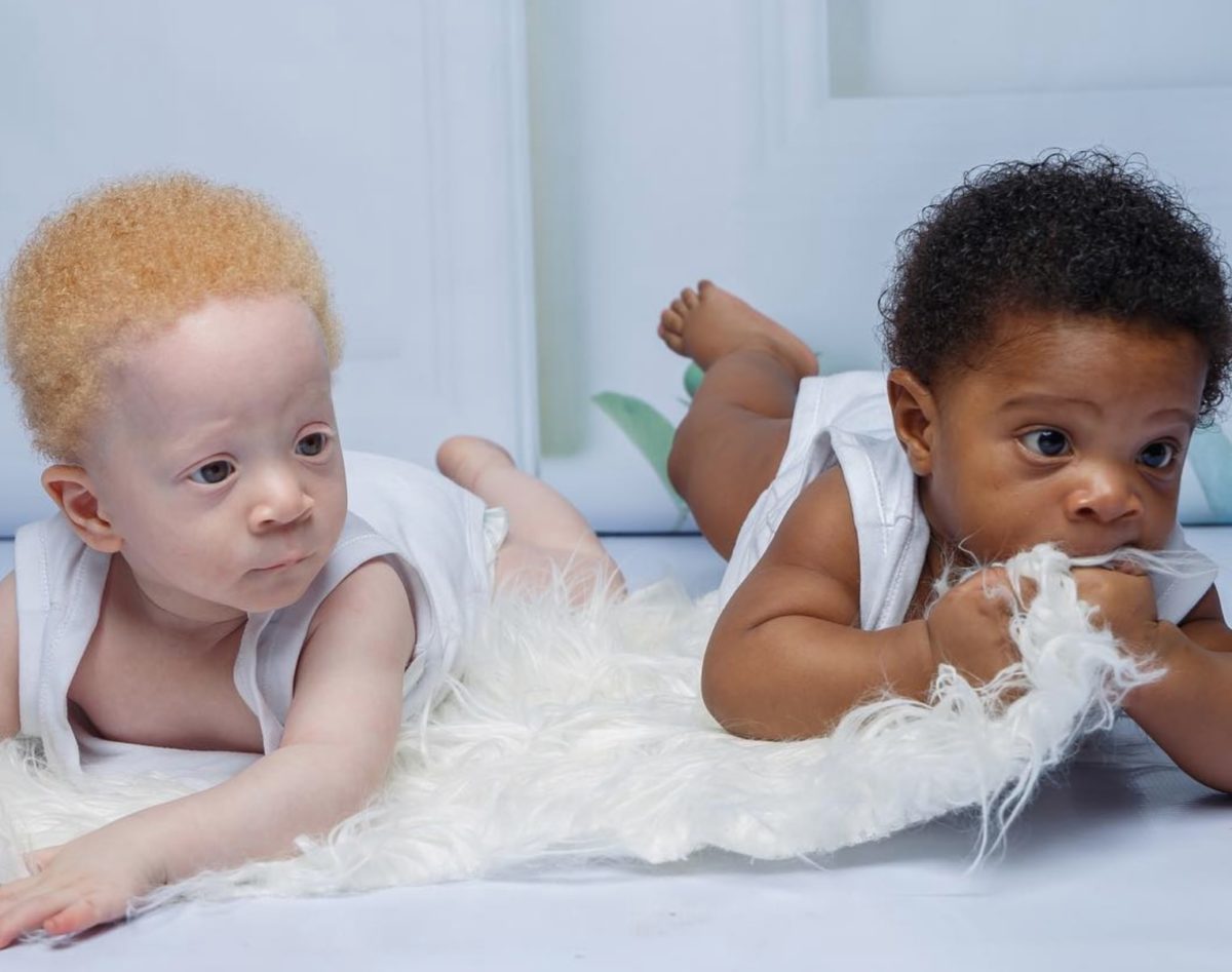 Mother's Set Of Twins Are Identical But Look Nothing Alike 