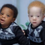 This Mother's Set Of Twins Are Identical But Look Absolutely Nothing Alike