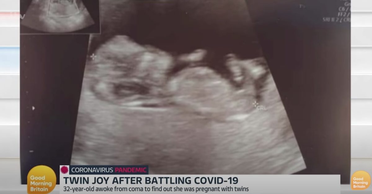 mom wakes from 10 day medically induced coma after contracting covid-19, she also learns she pregnant with twins | "it was the cherry on top of the cake knowing i had beat coronavirus and have twins on the way!"
