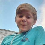 13-Year-Old Dies From Rare Brain-Eating Amoeba At Florida Water Park