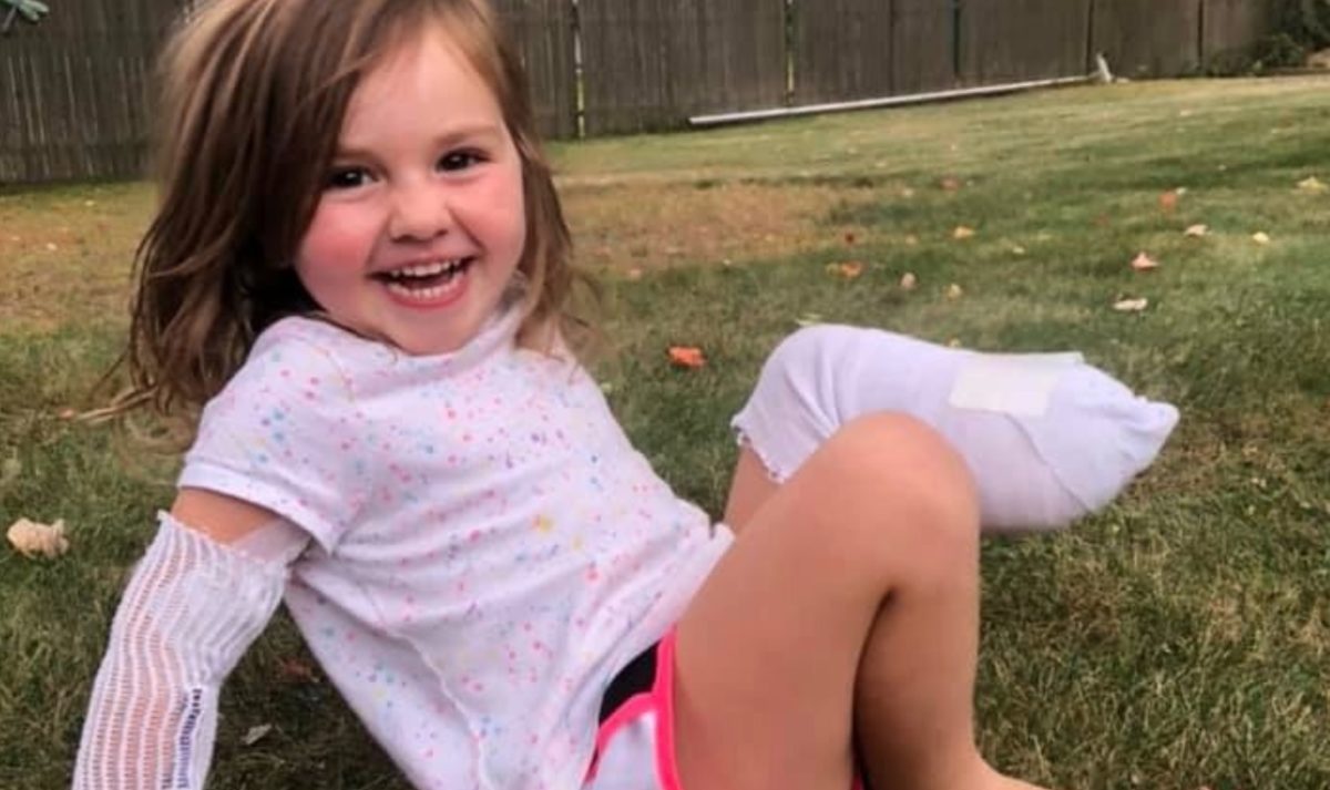 Mom Says 3-Year-Old Daughter Is Doing “Far Better Than All the Adults in Her Life' After Lawnmower Accident Takes Her Leg