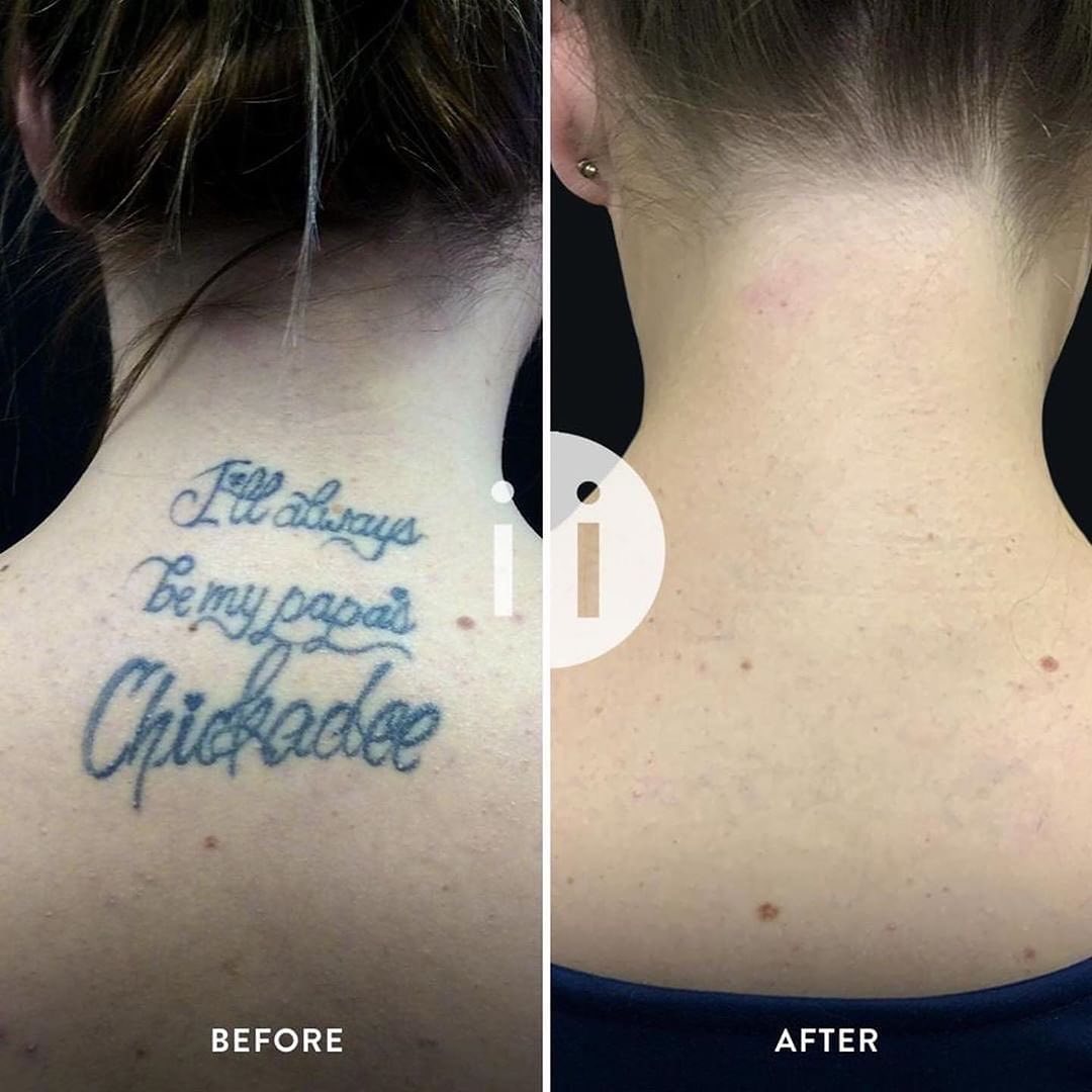 25 tattoos that people regret getting