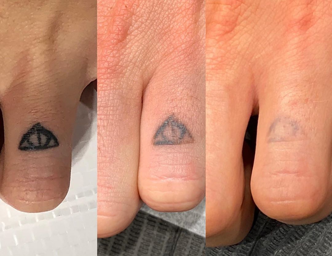 25 Tattoos That People Regret Getting