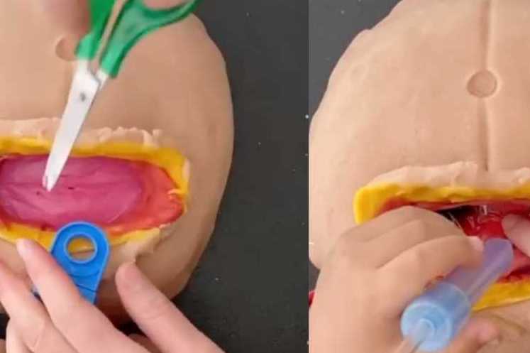 Mom Recreates C-Section Using Play-Doh