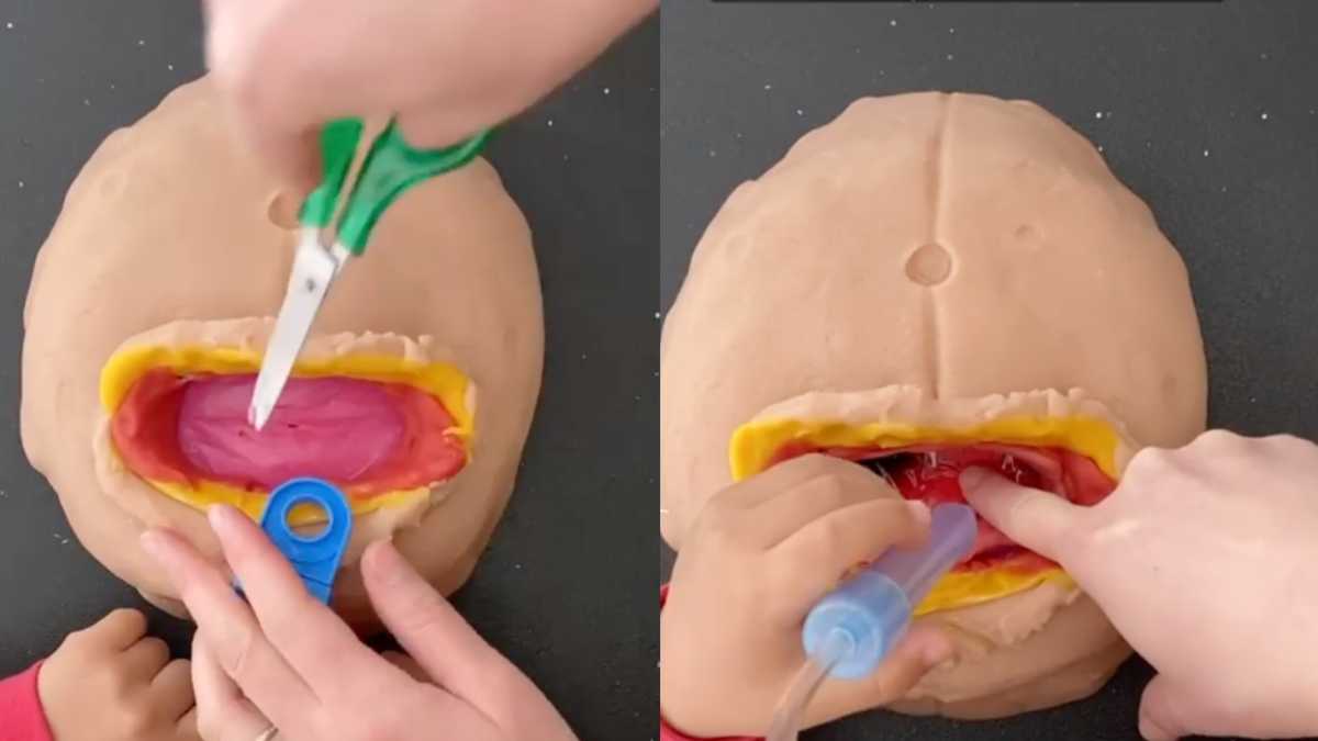 Mom Recreates C-Section Out of Play-Doh, Toddler Assists in 'Delivery'