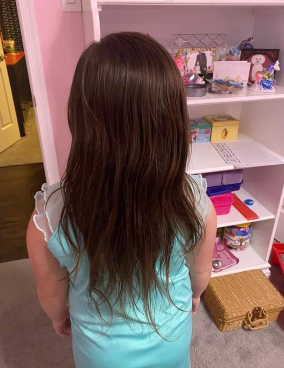 6-year-old daughter gets 150 velcro-like toys stuck in hair