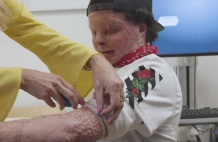 Man Undergoes World’s First Face and Hands Transplant