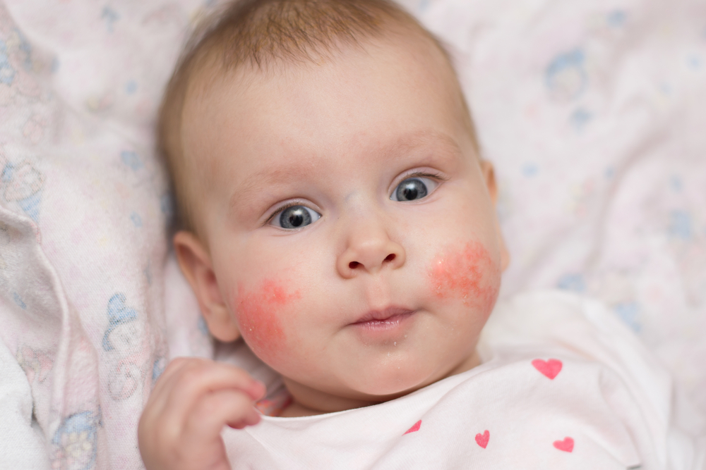 Mom Gives 2-Year-Old Painful Rash by Using Makeup to ‘Make Her Look Pretty’ 