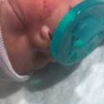 Newborn’s Face Sliced Open During Emergency C-Section, Requires 13 Stitches