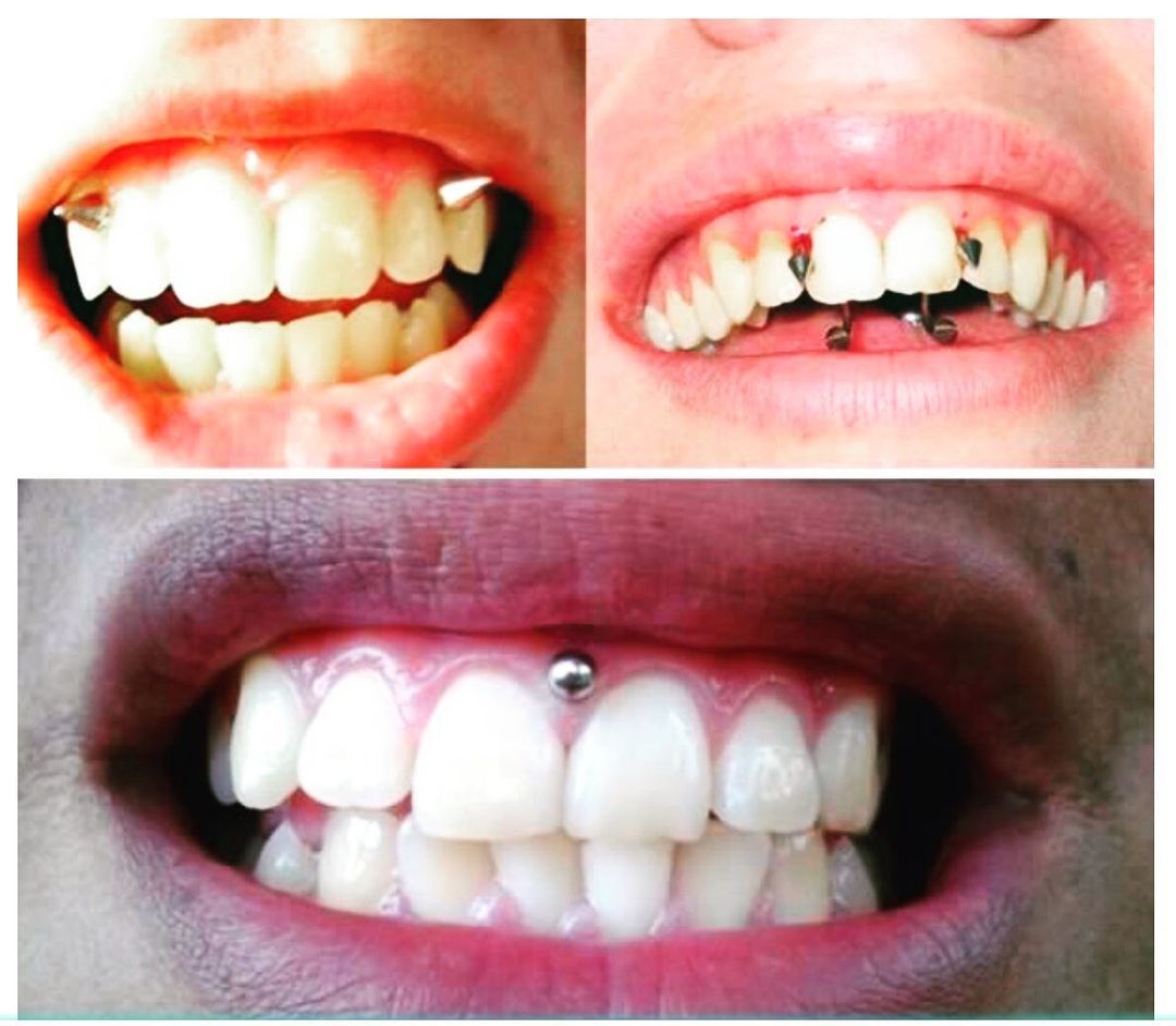 30 Extreme Piercings That Will Make Your Teeth Hurt