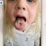 4-Year-Old Vows to Never Eat Sour Warheads Again After They Left Her in Serious Pain