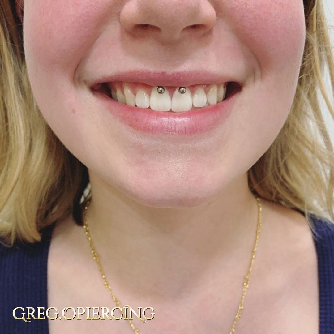 Ever Heard of a Smiley Piercing?