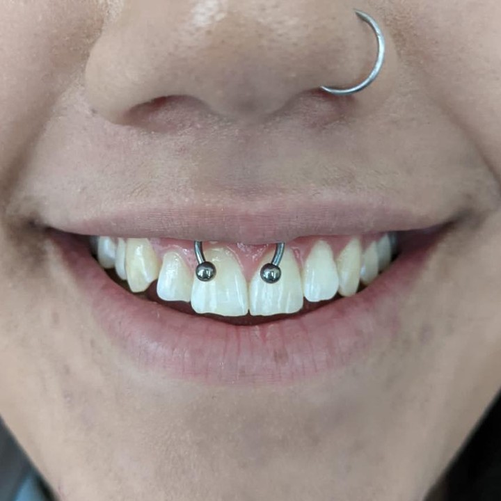 ever heard of a smiley piercing?