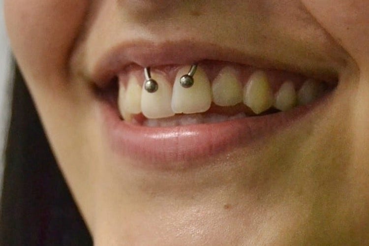 ever heard of a smiley piercing?