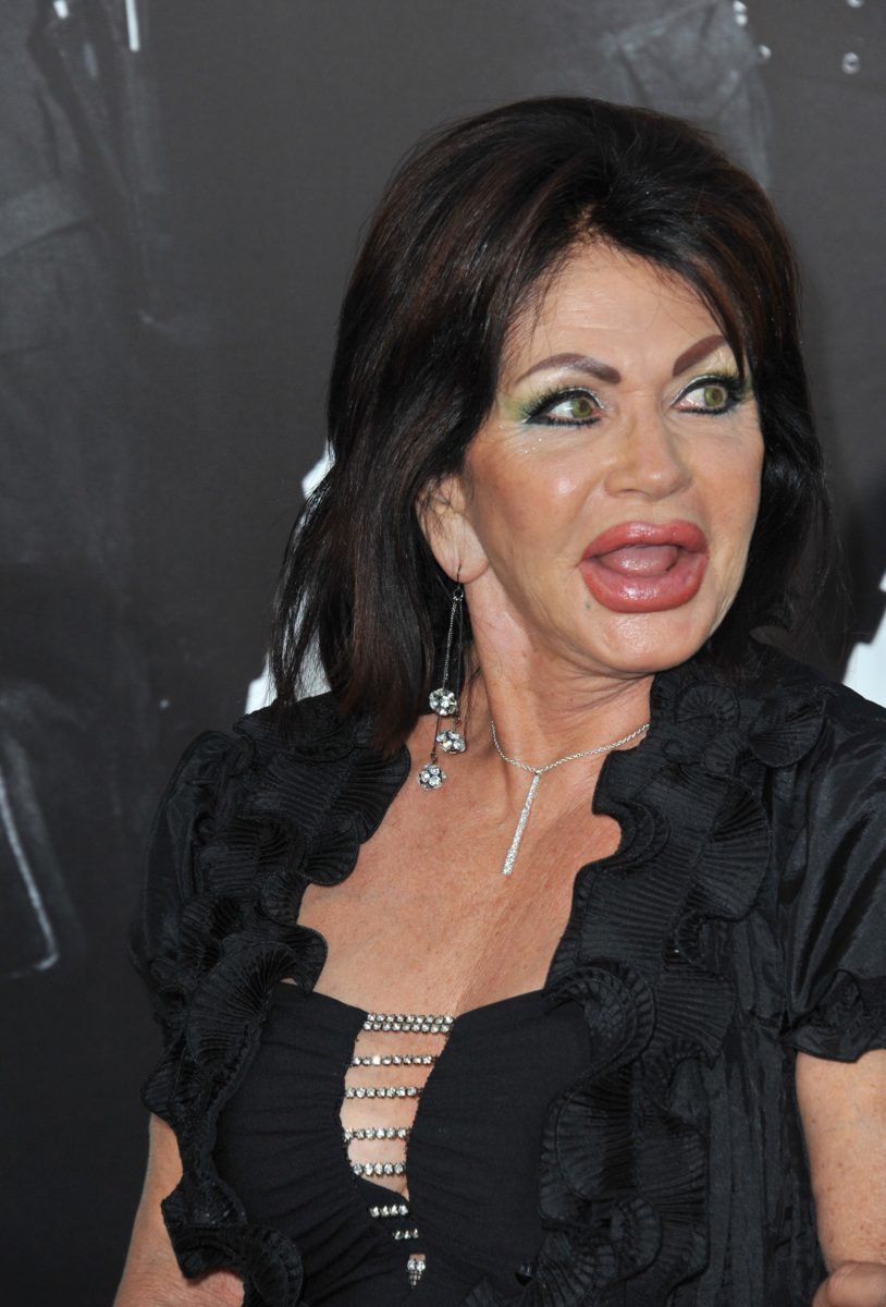 From Paralyzing Her Son During Birth to Hating Her Plastic Surgery: Sylvester Stallone's Moms Many Confessions