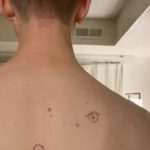 TikTok Wife Goes Viral For Sending Husband To Dermatologist With Circles Around His Concerning Moles, Doctor Leaves Notes For Her