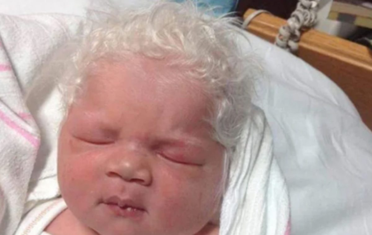 White-Haired Baby Bence Goes Viral On Reddit