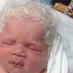 White-Haired Baby Bence Goes Viral On Reddit, The Truth Behind His Stunningly Bright Head Of Hair