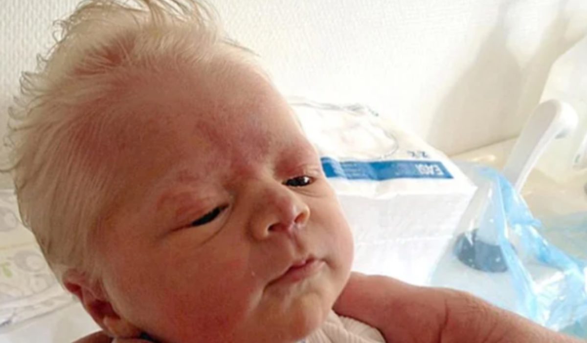 white-haired baby bence goes viral on reddit, the truth behind his stunningly bright head of hair