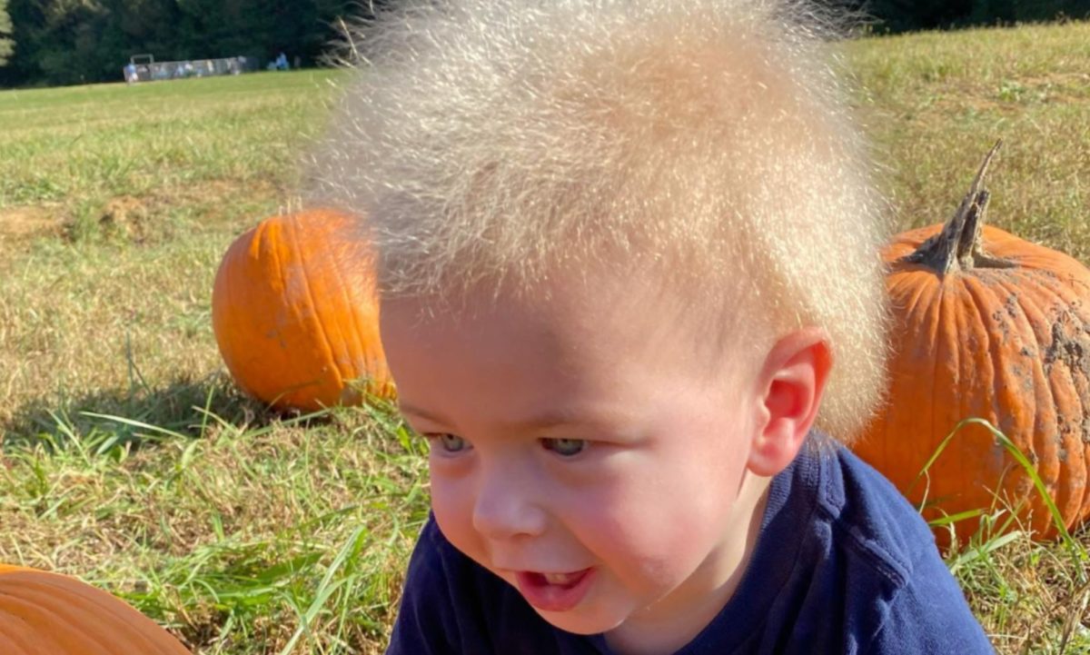 3-Year-Old Diagnosed With Rare, But Adorable, Uncombable Hair Syndrome