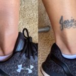 Tattoo Removal Before and After Photos You Need to See to Believe