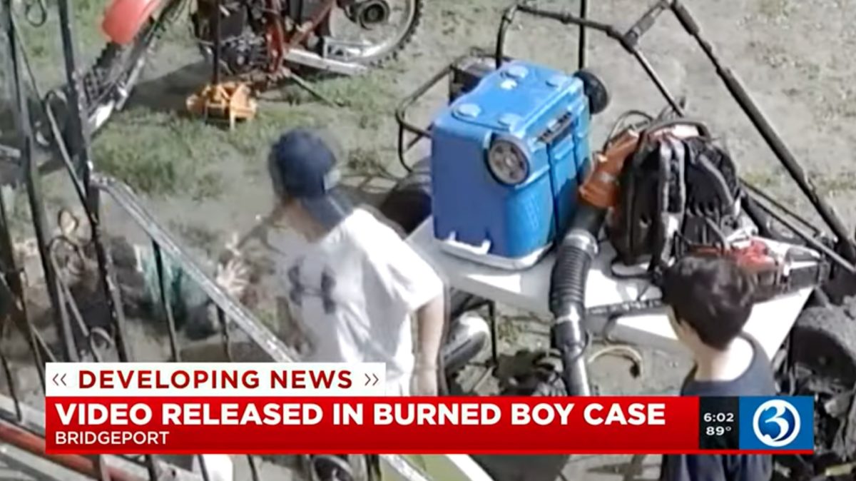 Child Burned By Alleged Ball of Fire