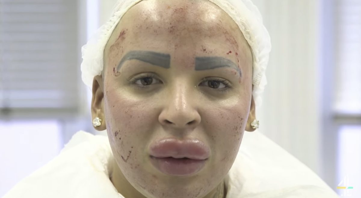 Plastic Surgery to Look Like Celebrities 