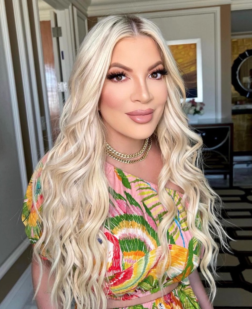 Tori Spelling is Here to Remind Us Why We Shouldn’t Leave Our Contacts in Overnight | Tori Spelling recently revealed the reason behind the eye patch she was forced to wear and it's a steady reminder to follow proper care and use with contacts!