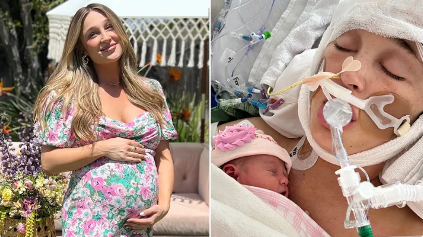 Months After Suffering a Brain Aneurysm While 39 Weeks Pregnant, Influencer Jackie Miller James Speaks Out for the First Time | Ten months after influencer Jackie Miller James was hospitalized after suffering a brain aneurysm one week before her due date, she is speaking out for the first time.